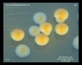 e.coli and salmonella